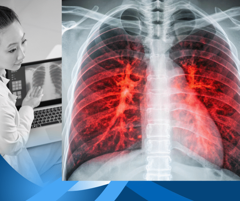 Lung Cancer Awareness Month Highlights Urgent Need for Early Screening and Public Education