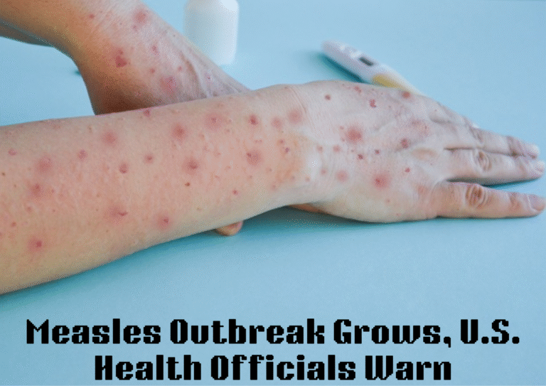 Measles Cases Surge Across the U.S., Prompting Renewed Public Health Warnings