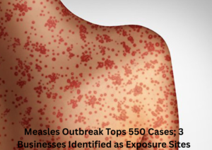 South Carolina Measles Outbreak Tops 550 Cases, Reaches North Carolina as Officials Warn of Low Immunization Rates