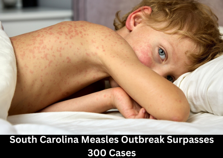 South Carolina Measles Outbreak Surges Past 300 Cases as Infections Accelerate